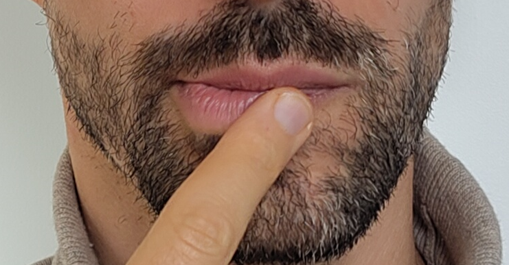 Lippen